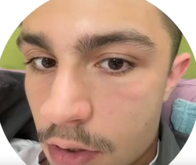 Никита Гуранда подозревает, что у него проблемы с почками