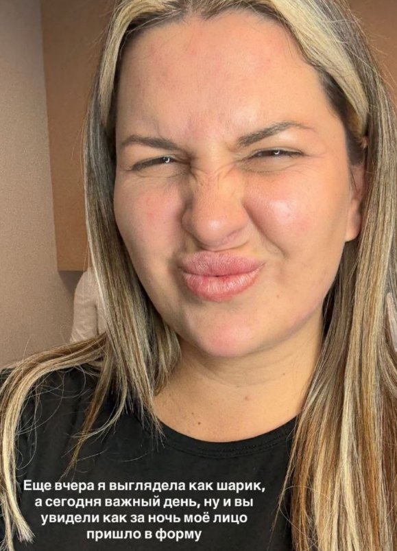 Майя Донцова устала ходить с лицом, как воздушный шар