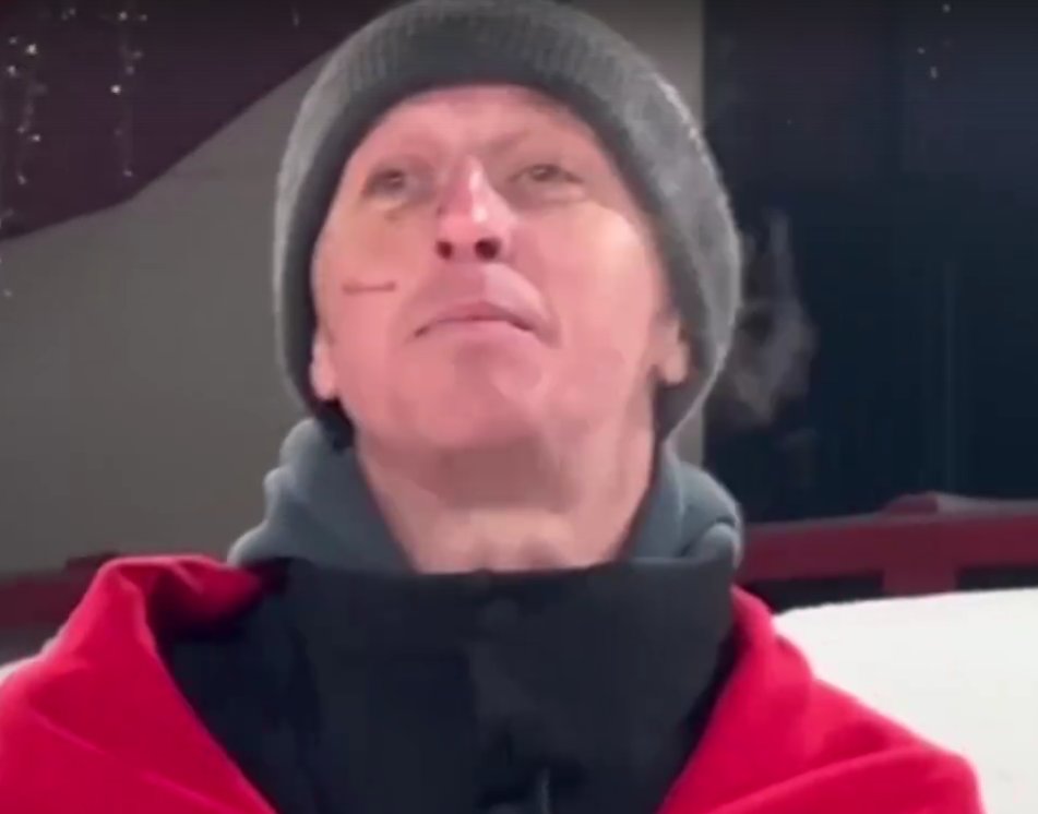 Катя Квашникова высказывает мнение, что Альберт Гракович сделал операцию слишком рано.