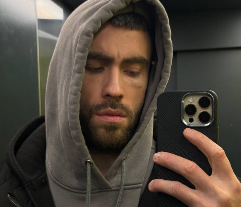 Игорь Григорьев утверждает, что получил "в глаз" на футболе, а не от Квашниковой