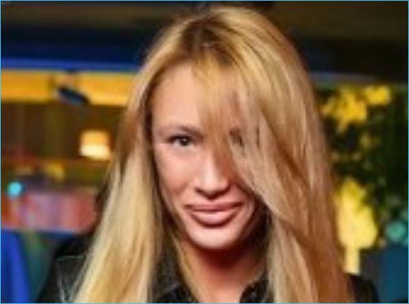 Алена Ашмарина довольна преображением своего лица