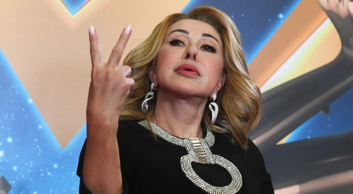 Пиар-менеджер Любови Успенской опроверг слухи об осложнениях перелома руки