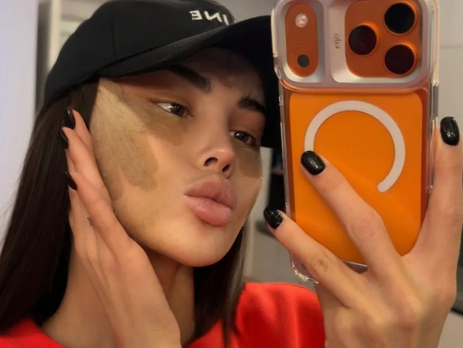 Яна Шафеева рассказала, какая операция превратила её в "китаянку"