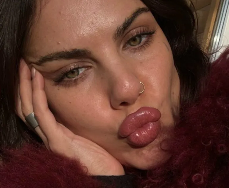 "Лечит цистит иголками?" - Алёна Опенченко нашлась в 100 км от Москвы