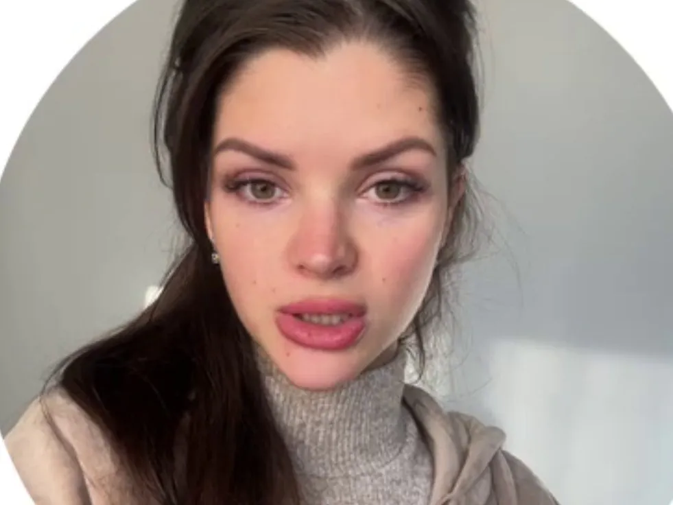 Анна Самонина пытается лечить аллергию у дочки без врача